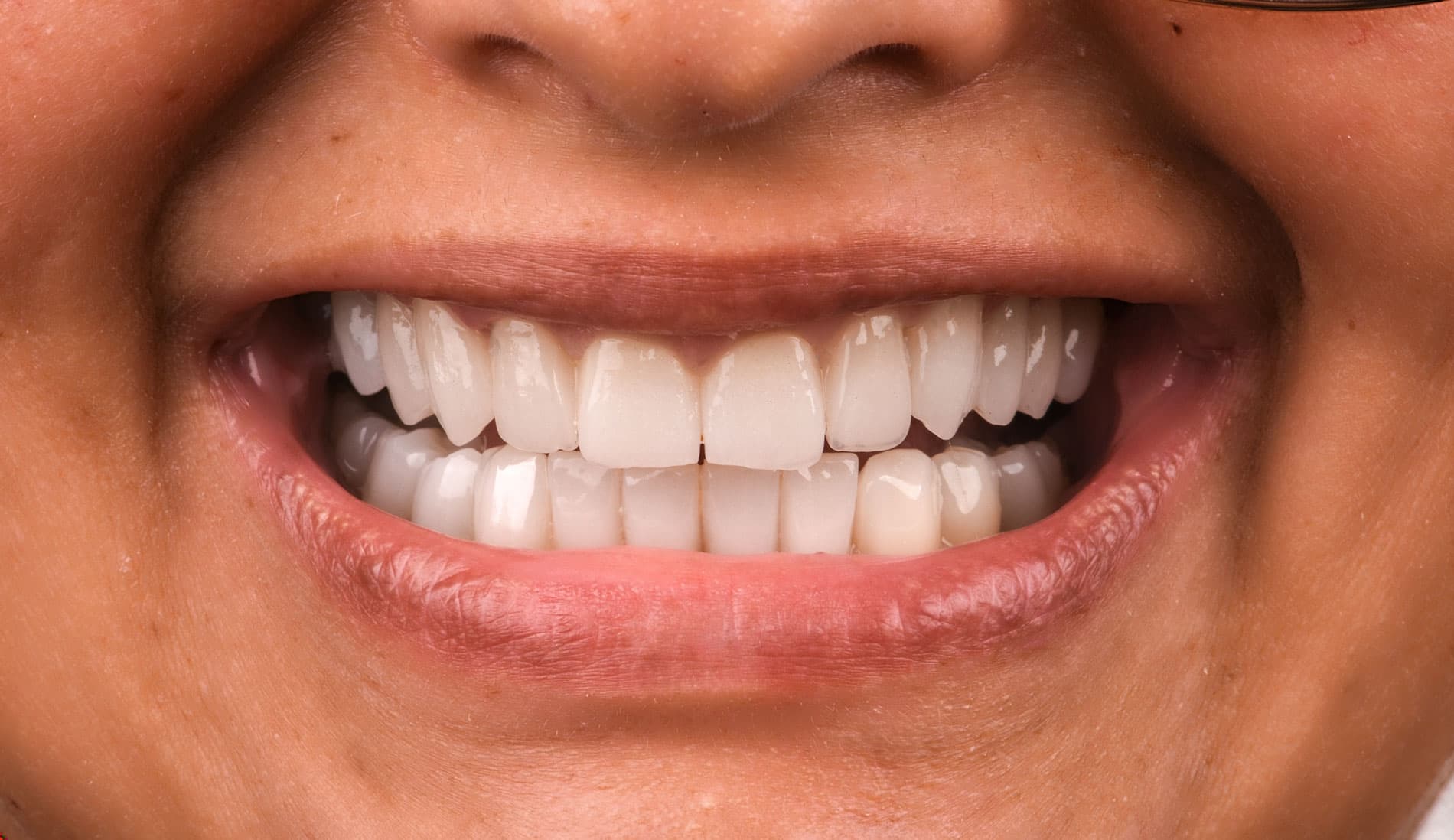 Aesthetic Dentistry